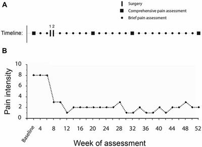 Deep Brain Stimulation Improves the Symptoms and Sensory Signs of Persistent Central Neuropathic Pain from Spinal Cord Injury: A Case Report